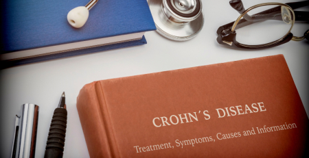 Doentes querem fármacos biológicos para doença de Crohn prescritos no privado