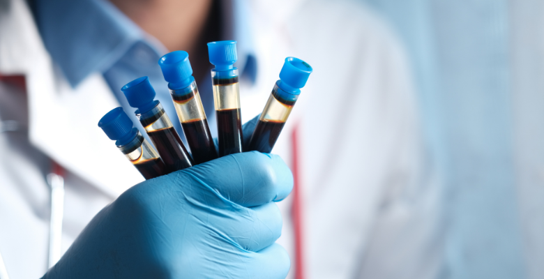 DNA microbiano no sangue permite diferenciar carcinoma hepatocelular de lesões metastáticas hepáticas