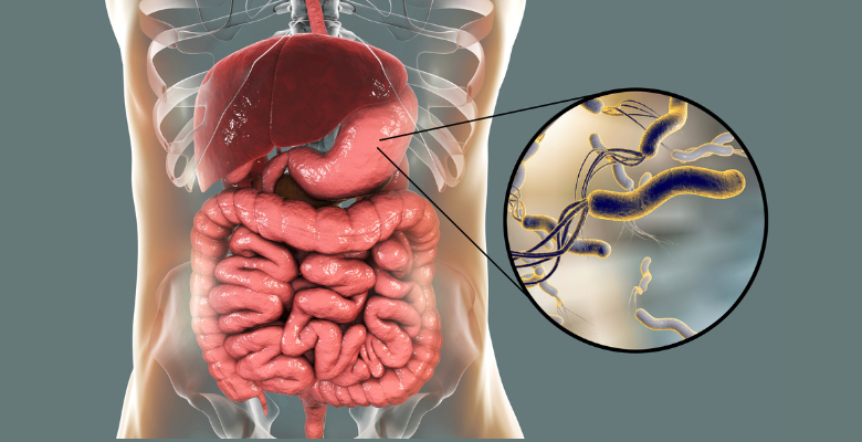Estudo associa erradicação de Helicobacter pylori ao aumento do risco de esofagite de refluxo