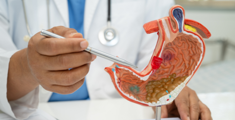 Portugal à frente no número de casos de cancro do estômago com destaque para o norte do país