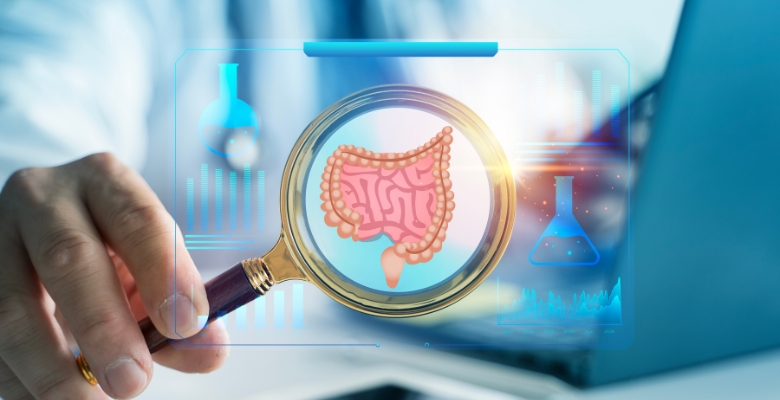 Calprotectina fecal: o biomarcador-chave na gestão da colite ulcerativa