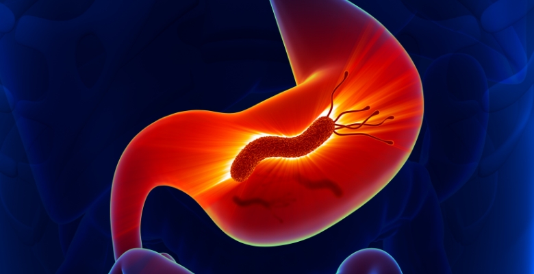 Programa “screen-and-treat” para H. pylori ganha força na prevenção do cancro gástrico