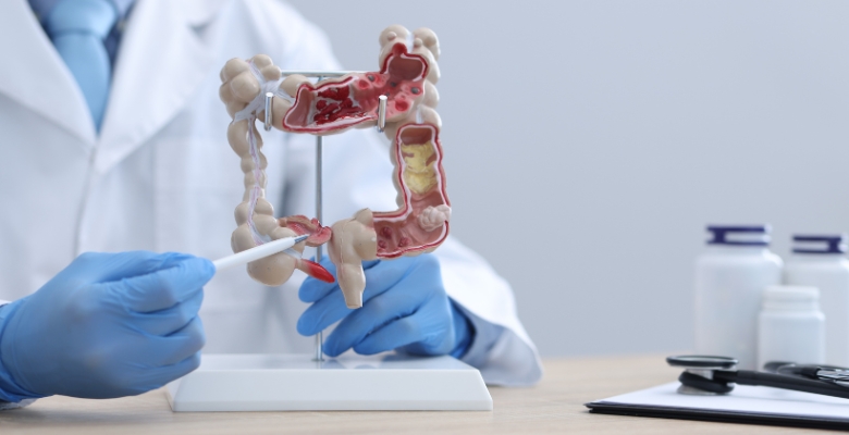 Investigação portuguesa abre caminho a estratégias preventivas na doença de Crohn