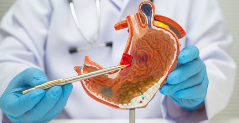 Cancro gástrico e esofágico: ESMO lança diretrizes focadas na Medicina de precisão e cuidados de suporte